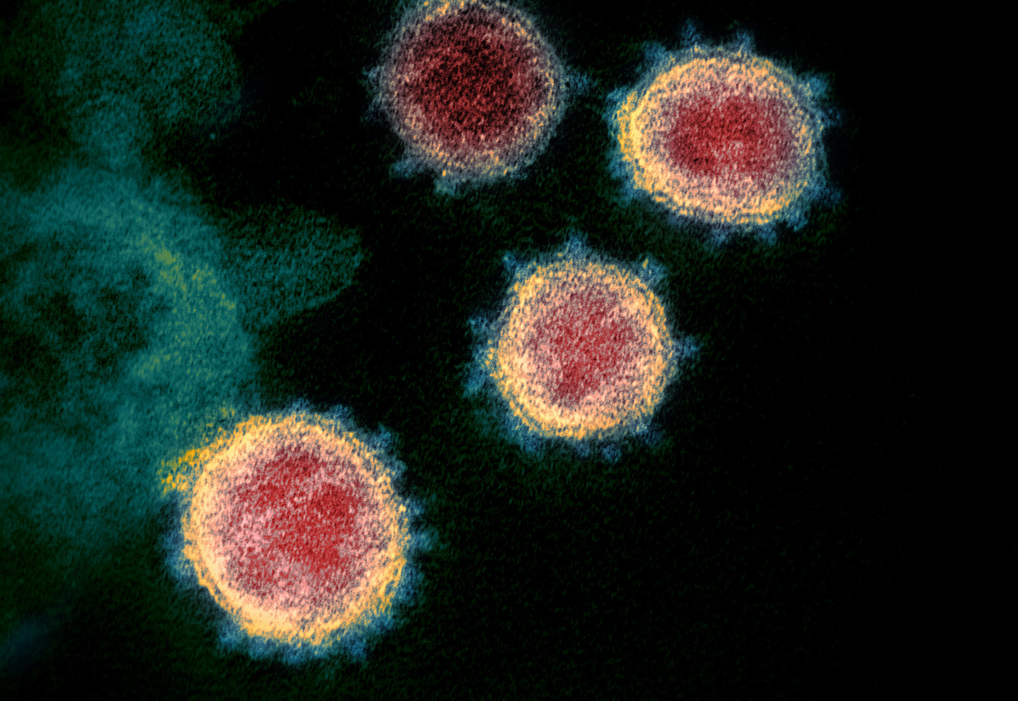 Virus SARS-CoV-2 lây lan nhanh hơn con người ước tính

